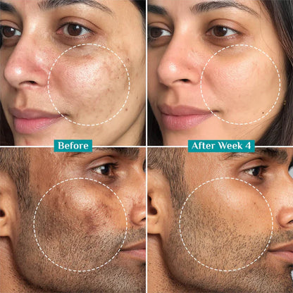 Pilgrim 15% Vitamin C Face Serum | With Ferulic Acid & Australian Kakadu Plum | Advanced Brightening Serum | All Skin Types | 20ml