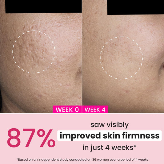 Dot & Key Pomegranate & Peptide Youth Restore Moisturizer SPF 30 | Anti Ageing Day Cream 60ml