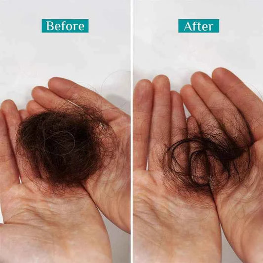 Pilgrim Spanish Rosemary & Biotin Anti Hairfall Shampoo | Reduces Hair Fall Due to Breakage | Sulphate & Paraben Free | All Hair Types | 200ml